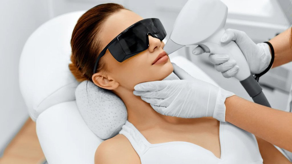 Mustață femei - Epilare definitivă laser