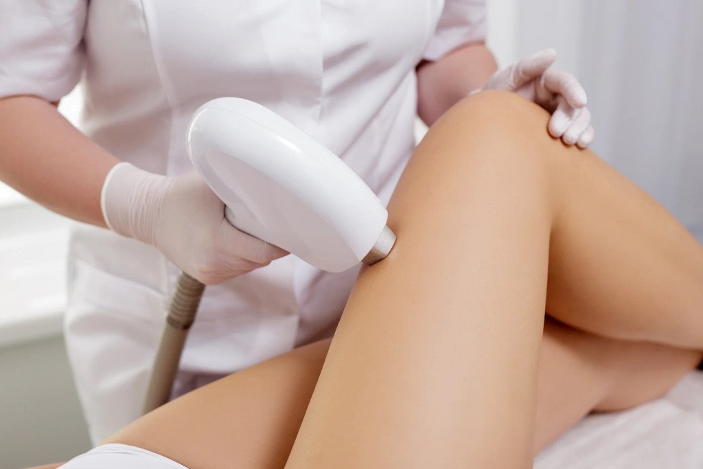 Picior integral femei - Epilare definitivă laser